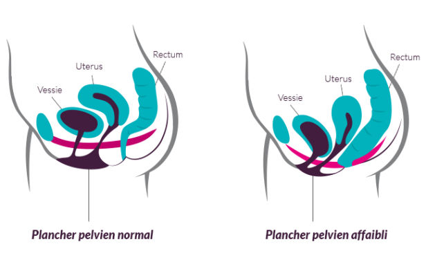 Le plancher pelvien : femme